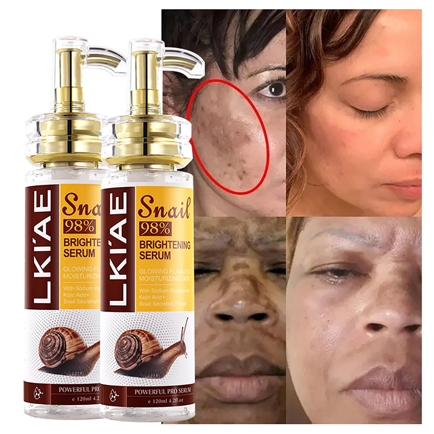 Snail 98 Face Serum Powerful 5 In 1 Anti Aging Kojic Acid And Arbutin Skin Care Essence Facial Whitening Snail Serum 120ml