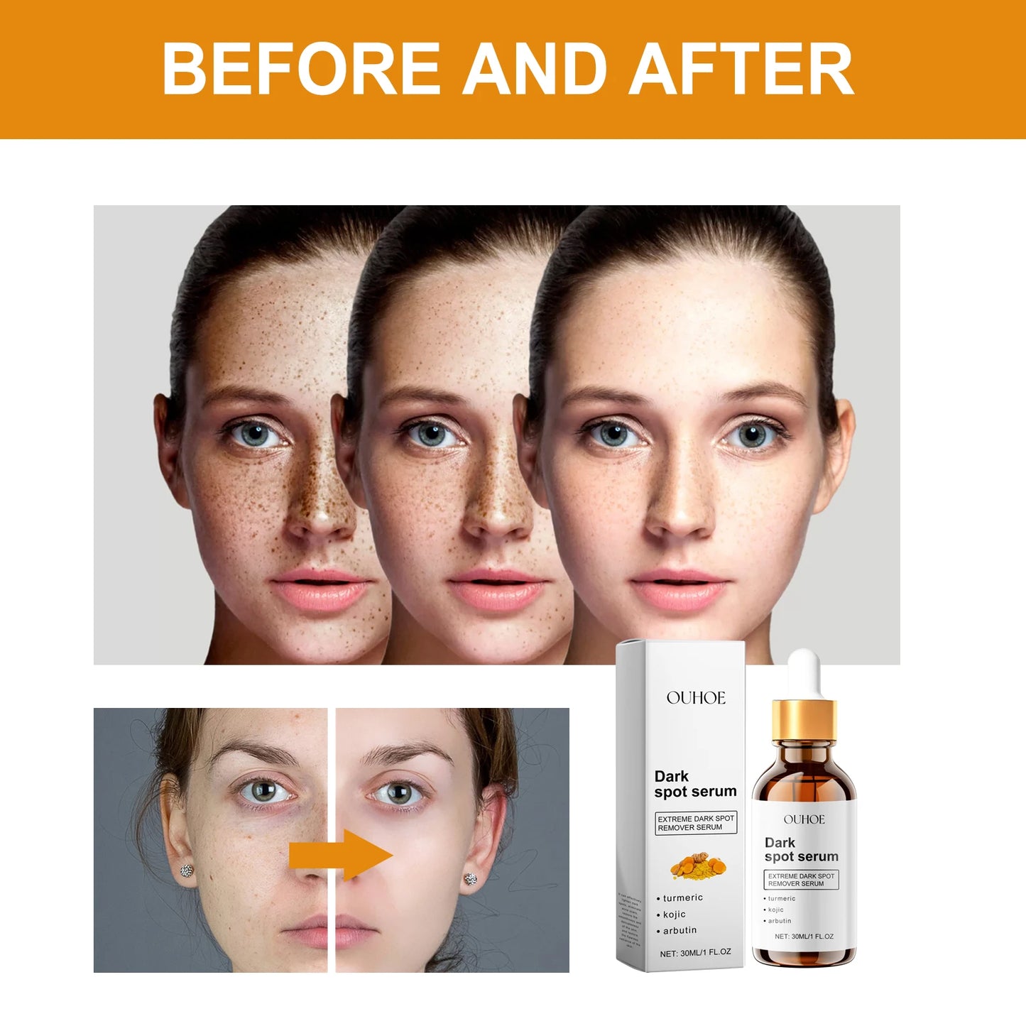 Brighten Skin Essence, Improve Melanin, Revitalize and Smooth Body Skin Care, Moisturize and Nourish Skin Care Products